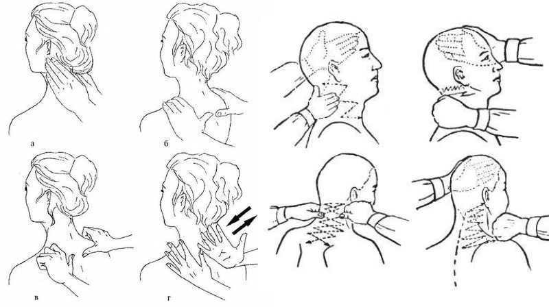 При выпячивании диска в шейном отделе используют только классический массаж