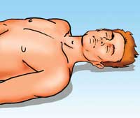 потеря сознания