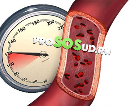 повышенное давление