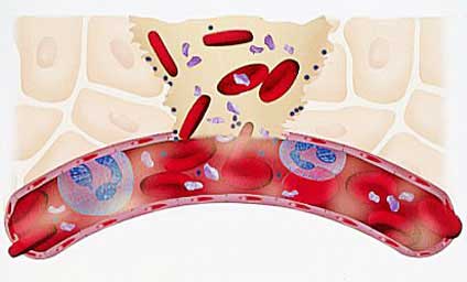повреждение сосуда