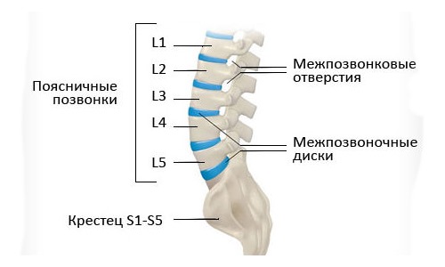 Иногда может встречаться сочетание смещения межпозвонковых дисков L4-L5 и L5-S1