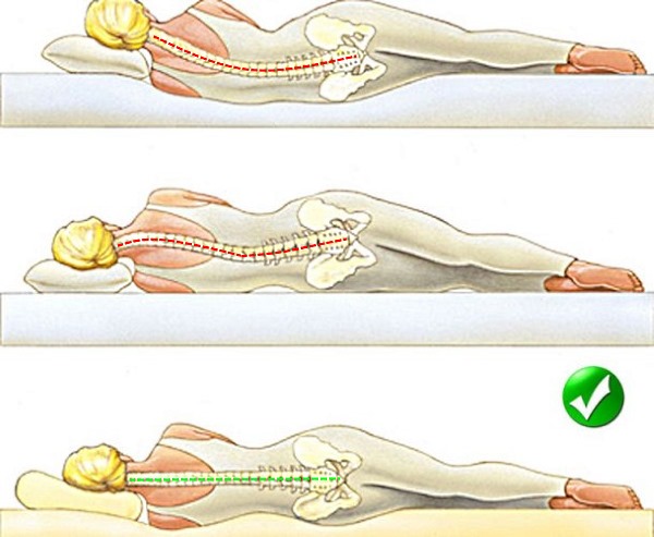 Чаще всего боли в спине после сна возникают из-за неправильного положения тела