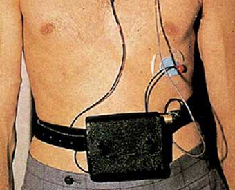 прибор для фонокардиографии