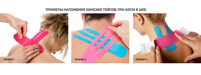 Примеры наложения медицинских лент на шею