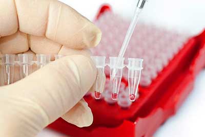 проба крови