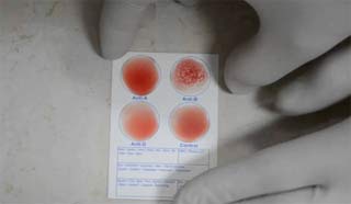 проба крови