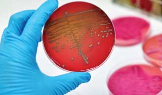 проба крови