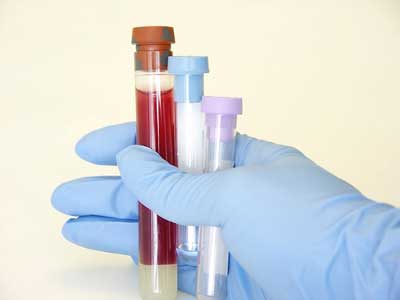 пробирка с кровью