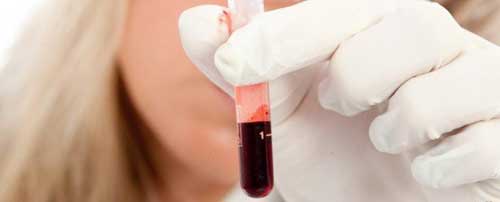 пробирка с кровью