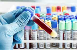 пробирка с кровью