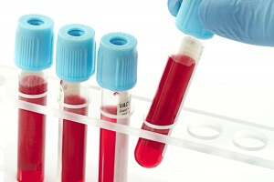 пробирки с кровью