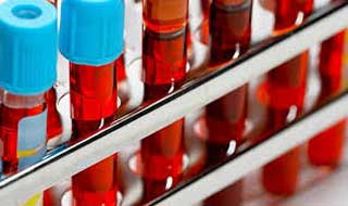 пробирки с кровью