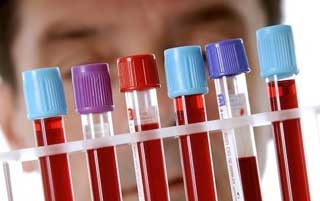 пробирки с кровью