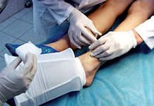 процедура склеротеропии