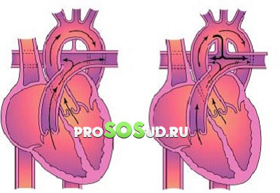 ток крови в сердце