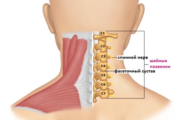Протрузия в шее является наиболее редкой, но самой опасной
