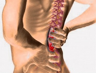 Острая стадия радикулита является противопоказанием к любым видам массажа