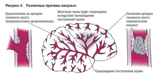 Развитие и симптомы