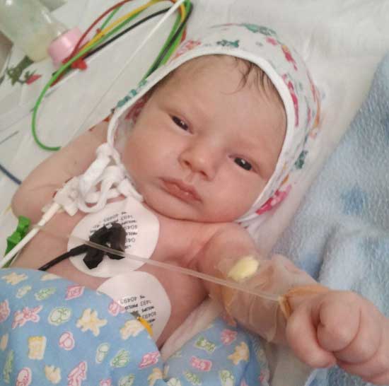 ребёнок с аневризмой перегородки