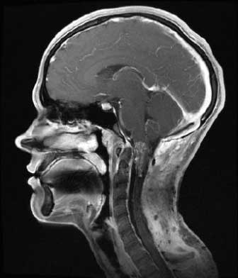 ренген головы