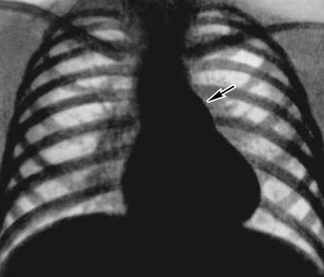 ренгенограмма