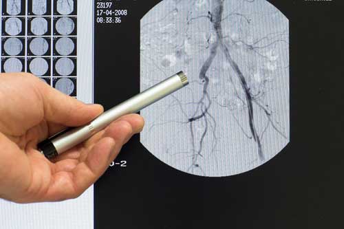 результаты обследования