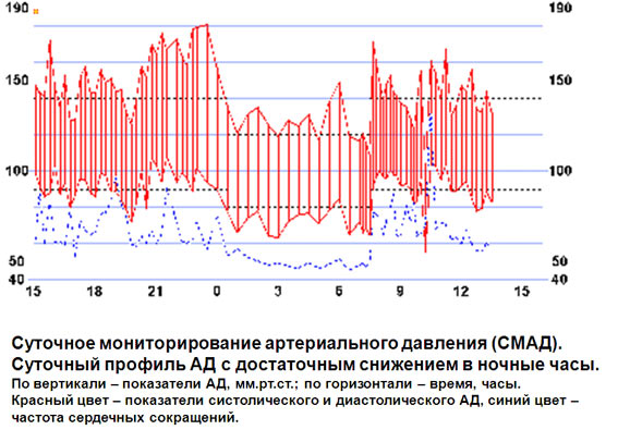 результаты мониторинга давления