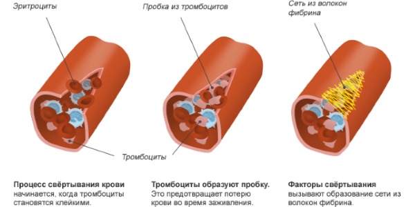 Из-за наличия в составе препарата ацетилсалициловой кислоты, при его приеме свертываемость крови замедляется
