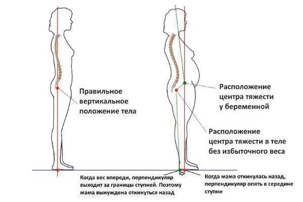 Центр тяжести тела при беременности смещается вперед, это усиливает нагрузку на позвоночник