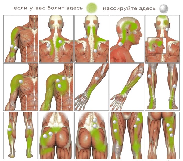 Места для устранения боли в мышцах с помощью массажа