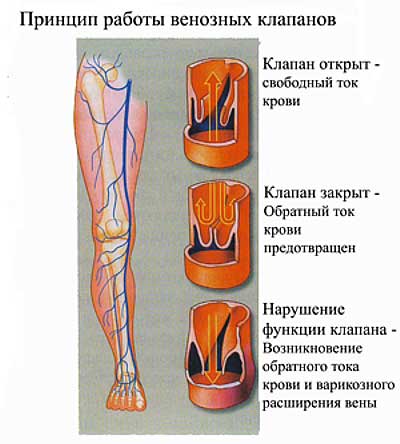застой крови в ногах