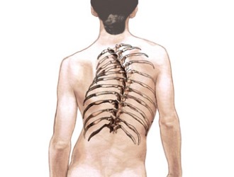 Из-за искривления позвоночника начинают деформироваться ребра, что приводит к неправильной работе внутренних органов