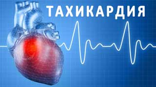 сердцебиение