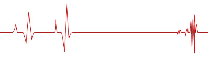 сердечный импульс