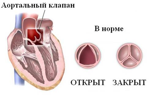 сердечный клапан