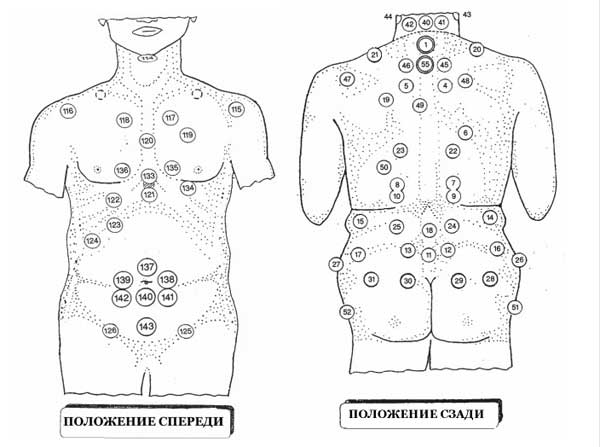 схема постановки на тело