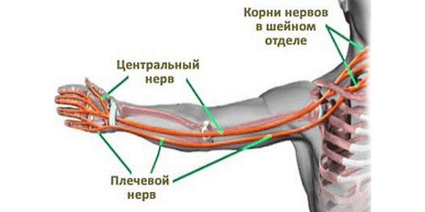 Цервикобрахиалгия - болевой синдром в шее иррадиирующий в плечо и руку