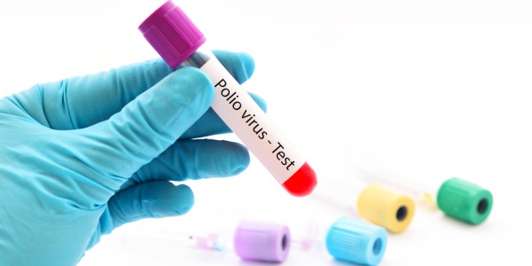 Ниже представлены симптомы всех видов полиомиелита