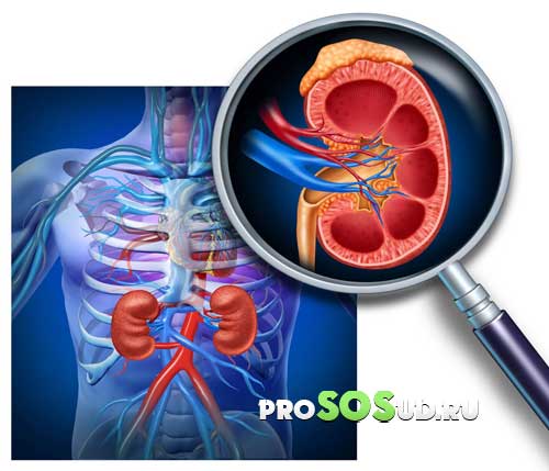 Симптомы реноваскулярной гипертензии