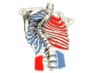 При сколиозе происходит деформация грудной клетки, что ведет к нарушениям в работе внутренних органов