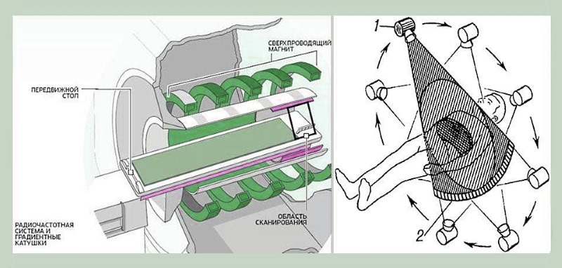 Принцип работы томографа