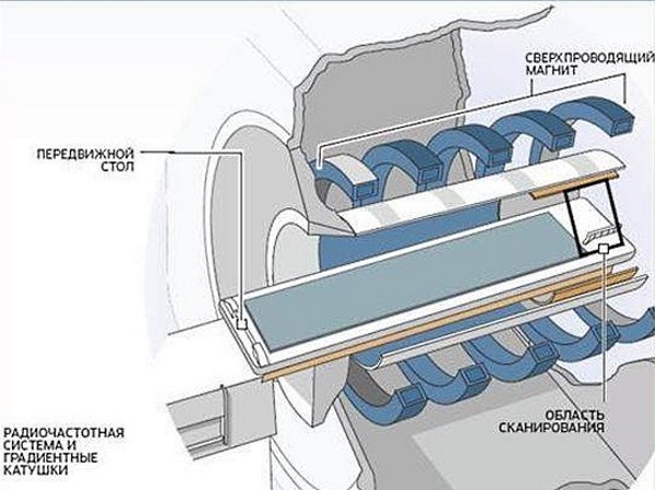 МРТ позволяет обследовать мягкие ткани вокруг позвоночника
