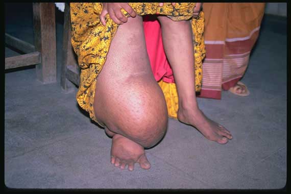 запущеная стадия