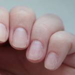 Слоящиеся ногти