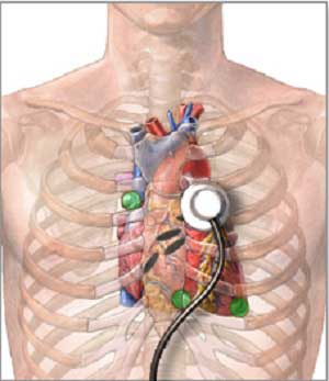 выслушивание сердца