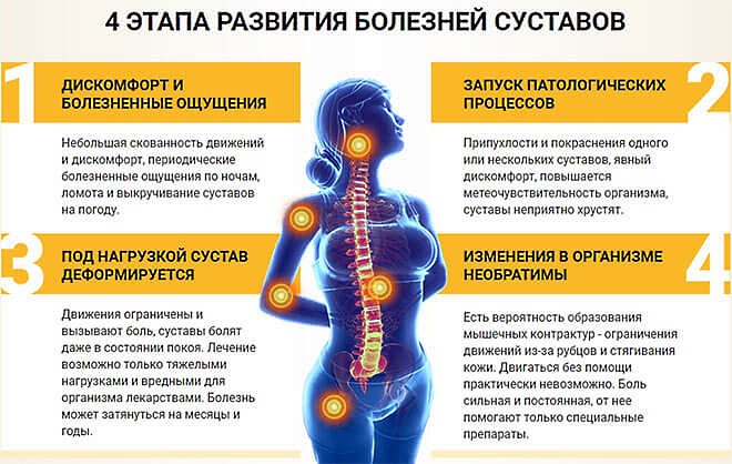 Обратите внимание на этапы развития заболеваний суставов