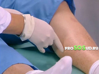 сосуды на ногах