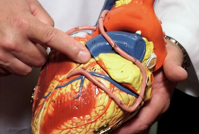 сосуды сердца