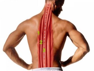 Необходимо укреплять мышцы спины - это позволит сохранить позвоночник в нужном положении