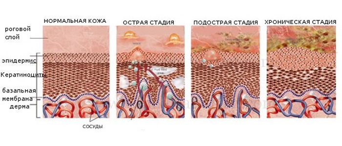 Мазь для наружного применения используют при кожных заболеваниях